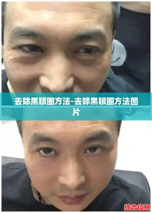 去除黑眼圈方法-去除黑眼圈方法图片 去除黑眼圈方法-去除黑眼圈方法图片
