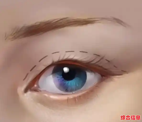 探索安全快速的双眼皮形成术与日常护理秘诀