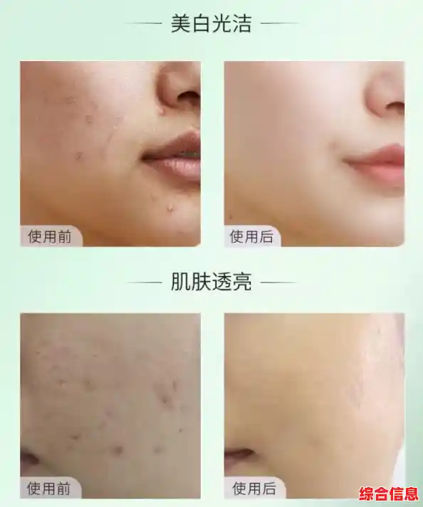告别痘印困扰:这些高效护理技巧让你重拾自信美肌 告别痘印困扰:这些高效护理技巧让你重拾自信美肌