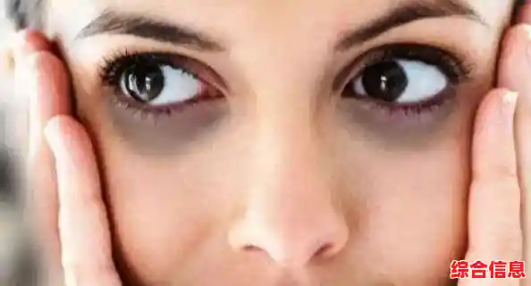 彻底淡化黑眼圈:自然安全且长效的日常护理秘诀与策略 彻底淡化黑眼圈:自然安全且长效的日常护理秘诀与策略
